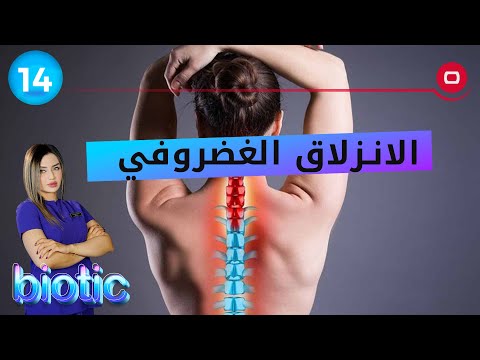 شاهد بالفيديو.. الانزلاق الغضروفي - م٢ - Biotic الحلقة ١٤