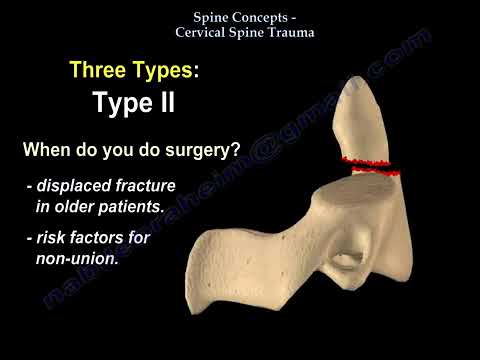 Cervical Spine Trauma - Everything You Need To Know - Dr. Nabil Ebraheim