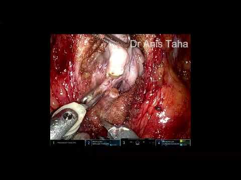 Anis Taha-21