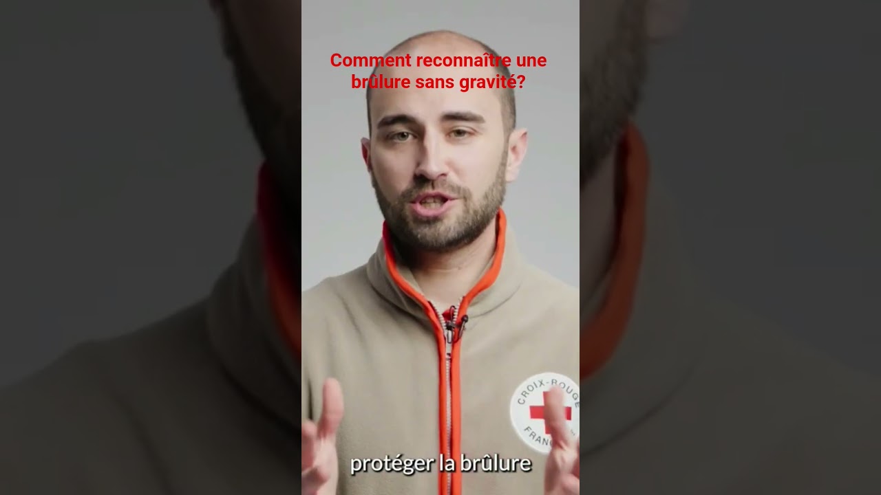 Comment reconnaître une brûlure sans gravité ? #shorts