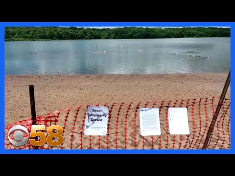 One simple trick will beat brain-eating amoeba