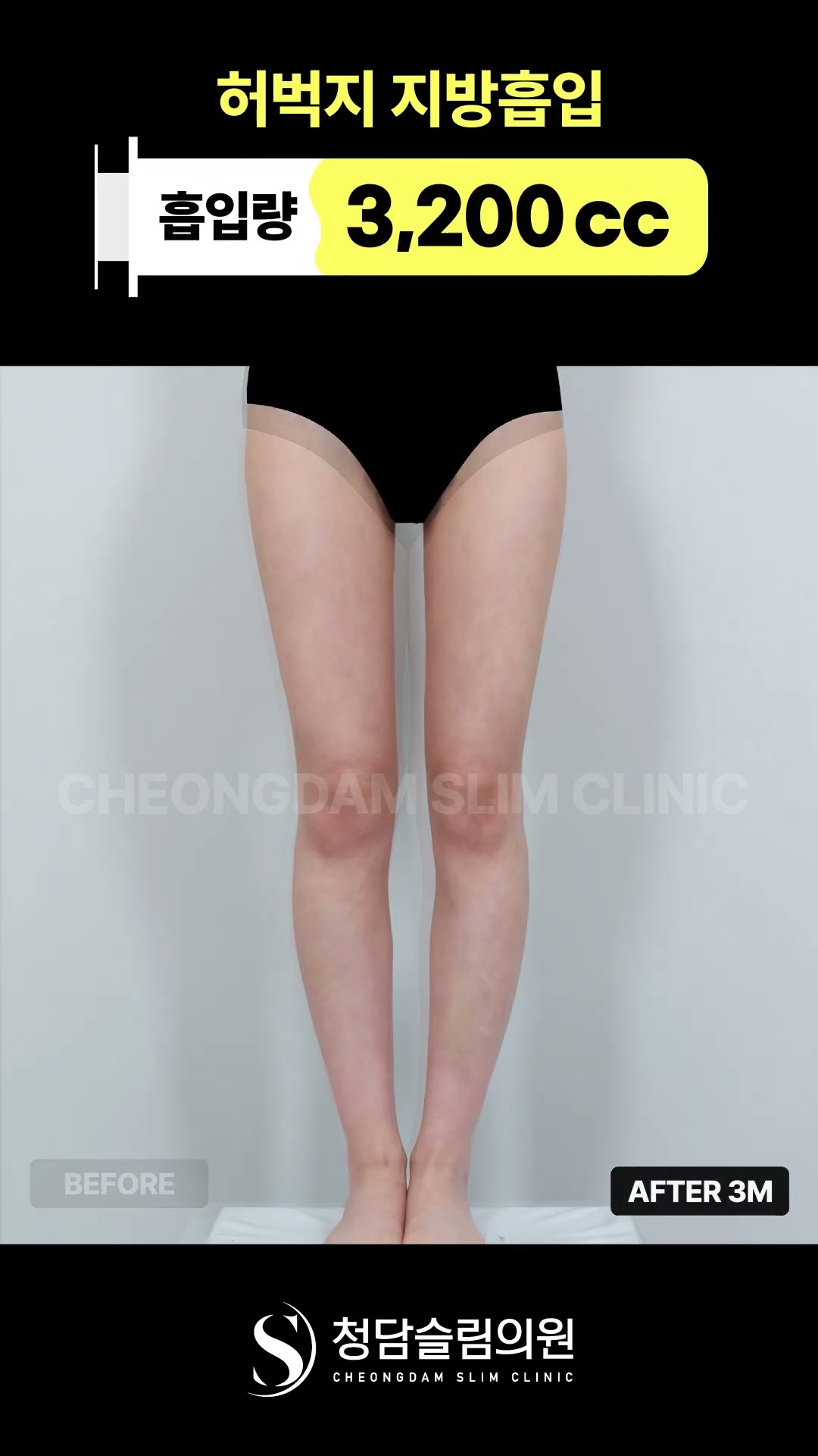 뼈벅지 바로 이런거죠?🥰