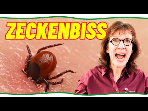 Natürliche Hilfe beim Zeckenbiss