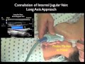 Ultrasound Guidance for Central Venous Access - Part 2 - SonoSite, Inc.