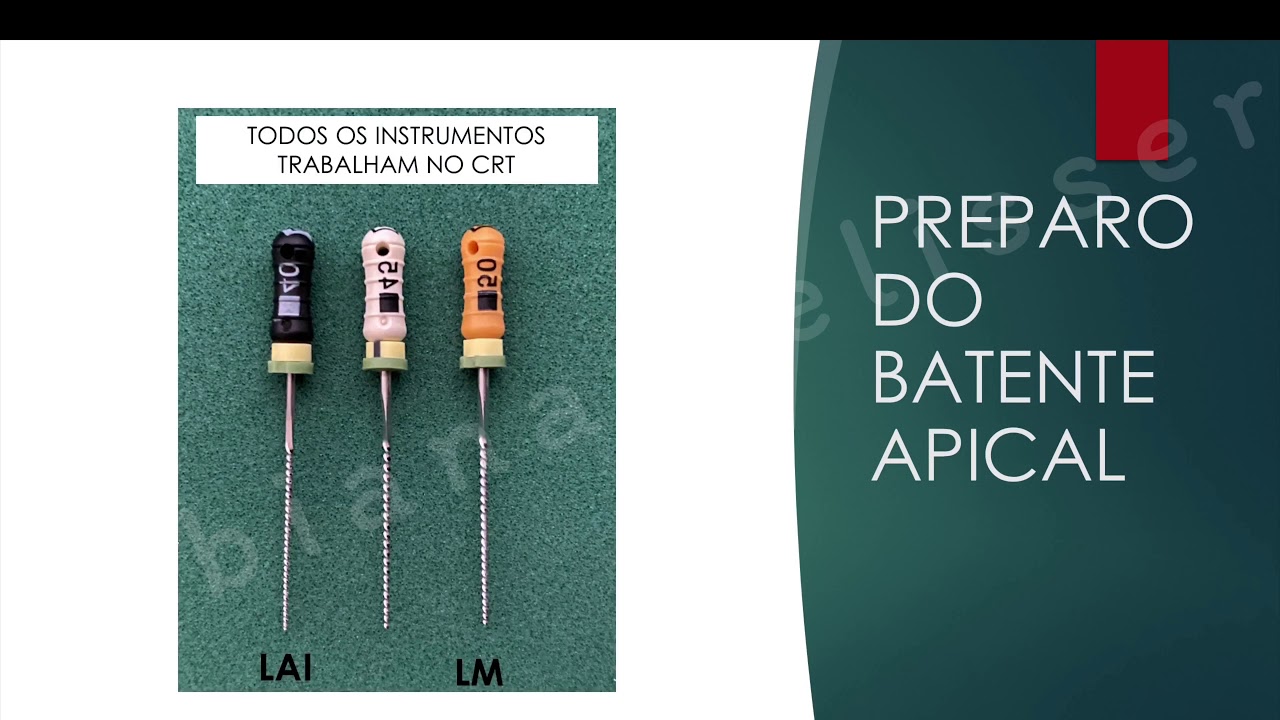 Preparo do canal radicular - Técnica coroa-ápice (limas convencionais) -  Prof Fabiana Vier Pelisser