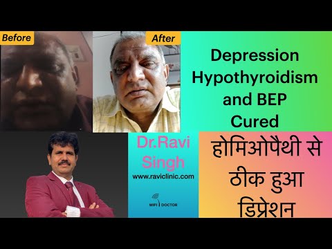 Depression During Lockdown cured along with BEP and Hypothyroidism with Classical Homeopathy