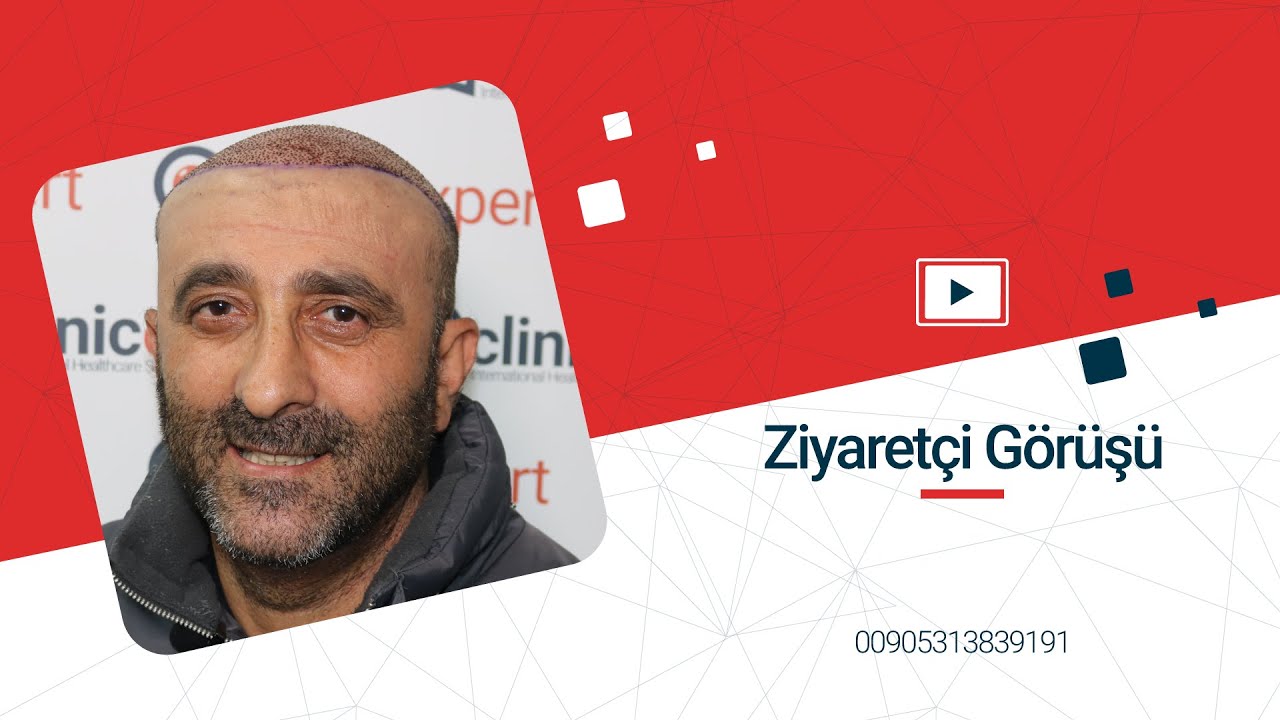 Saç Ekimi ve Estetik Cerrahi