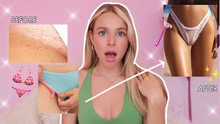 The TRUTH About Treating Ingrowns | Best Bikini Line Shave Routine to Make Them Go Away For GOOD!