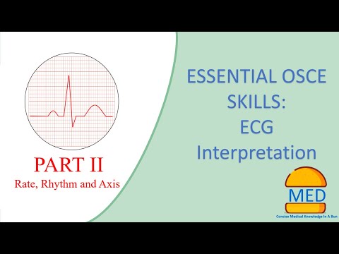 OSCE ESSENTIALS - ECG INTERPRETATION PART 2 (Rate, Rhythm and Axis)