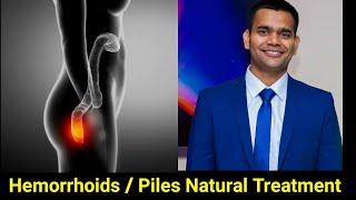 Piles Natural Treatment | How To Shrink Hemorrhoids Fast And Naturally / Dr. Vivek