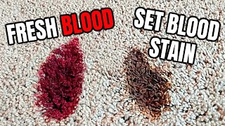 How to Remove BLOOD STAINS From Carpet