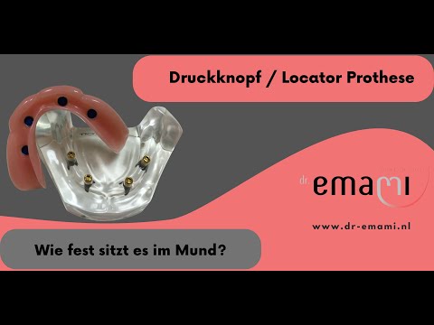 Gaumenfreie Prothese, Druckknopf Prothese, Locator Prothese, Steg Prothese, Prothese auf Implantate,