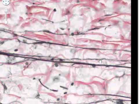 Connective Tissue Part 4 - Elastic and reticular fibres