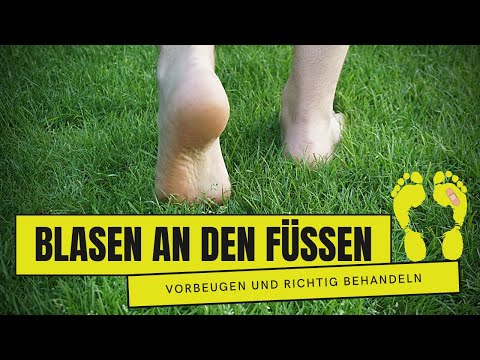Wie wroschi den Nagel behandeln Die Mittel für die Behandlung des Nagelzwanges