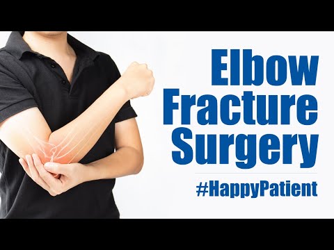 Elbow Fracture Surgery in Kakinada | Medicover Hospitals - Video Thumbnail