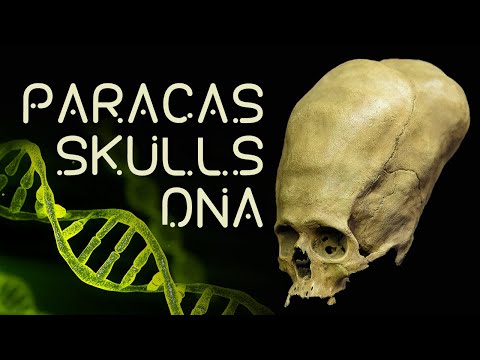 Paracas Skulls DNA, Nephilim, and Phoenicians | Timothy Alberino talks with L.A. Marzulli