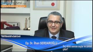 Saç ekimi sonrası saçlar ne zaman çıkar?