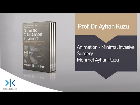 2.1.2. Animation - Minimally Invasive Surgery - M. Ayhan Kuzu