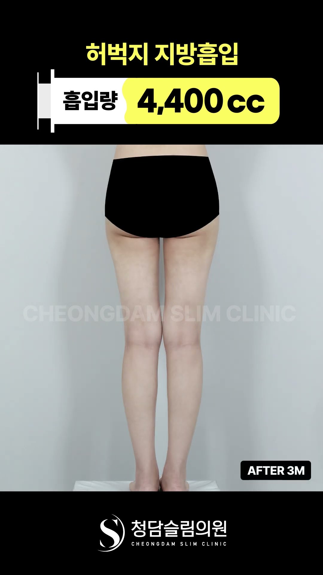 날씬에서 마름으로 가는 방법