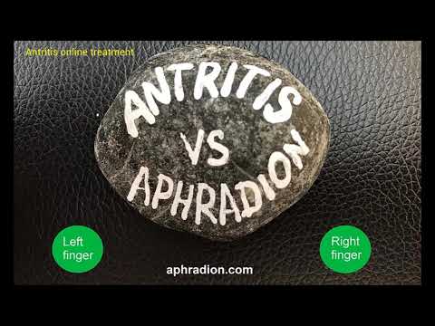 download lagu mp3 mp4 Antritis, download lagu Antritis gratis, unduh video klip Antritis