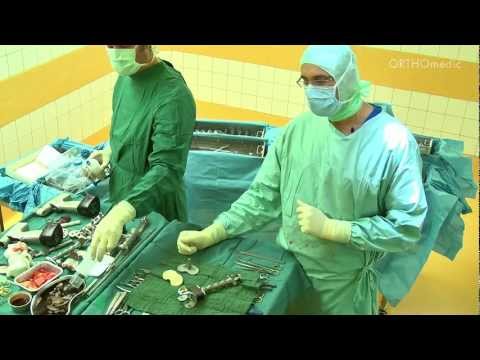 Sehr wunder unterer Rücken und Knie Osteochondrose der Brust LRV