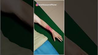 😱DANGEROUS! How Flesh Eating Bacteria Kills?