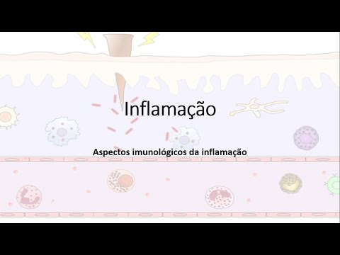 Inflamação, Resposta inflamatória, Quimiocinas; Migração leucocitária; Fagocitose.
