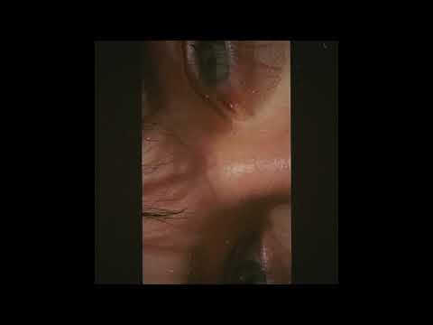 [FREE] Lomepal Type Beat "Cassidy" (Prod. IVERRN)