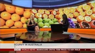 SCURVY RESURGENCE FROM FAD DIETS | BBC World | Nutritionist Rhiannon Lambert