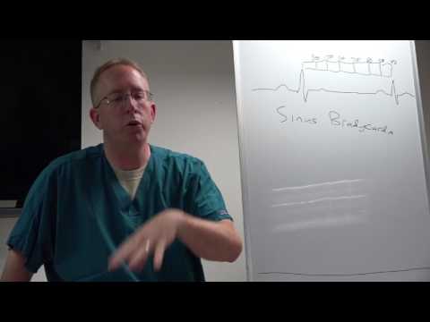 Bradycardia Recognition