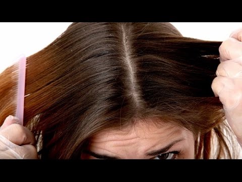 La ricetta di una maschera per capelli con cognac e miele Trattamento di capelli risposte di Tjumen