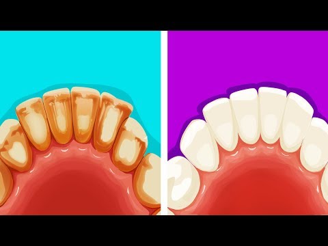 download lagu mp3 mp4 Why Do My Teeth Feel Rough, download lagu Why Do My Teeth Feel Rough gratis, unduh video klip Why Do My Teeth Feel Rough