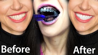 Fastest Way To Whiten Teeth At Home (What REALLY Works)