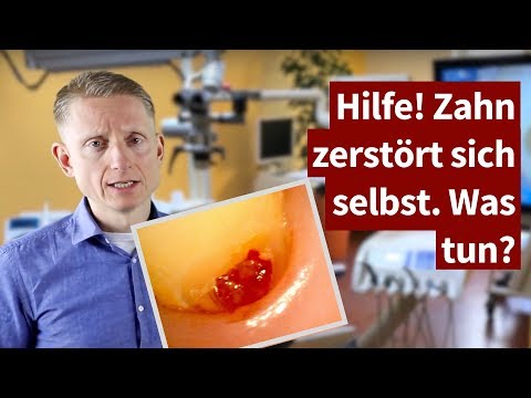 Rückenschmerzen kann nicht gebogen werden Ivan Gelenke