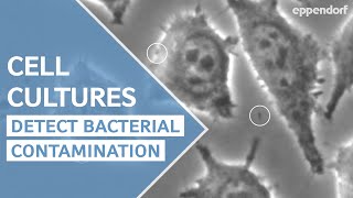 How to detect bacterial contamination in cell culture - moving particles are not always bacteria