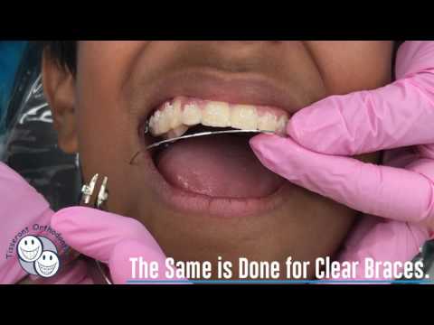 How are Wires Changed?