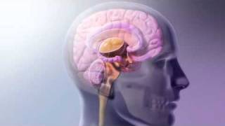 Head Trauma Brain Damage