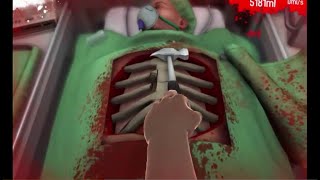 preview picture of video 'لعبة الدكتور المحشش من سلسلة العاب ع السريع البرنامج الاسبوعي (Surgeon Simulator)'