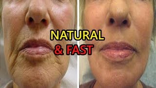 How to Get Rid of Wrinkles Around The Mouth Naturally Fast
