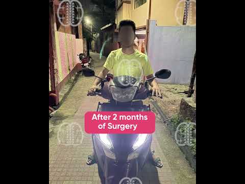 Paralyzed After a Road Accident | Remarkable Spine Surgery Recovery by Dr Garga Basu