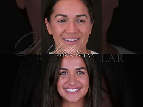 Rowan Vilar-19