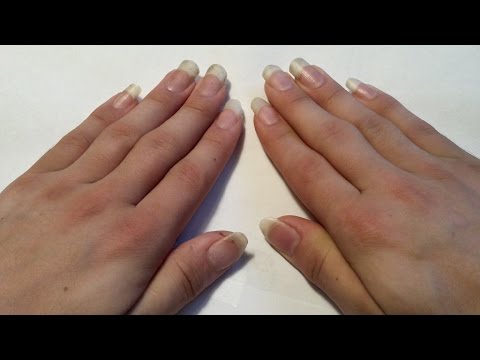 Fingernail Time Lapse (13 weeks without clipping)