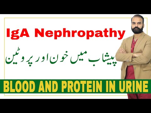 Blood and Protein in urine | ?IgA Nephropathy in Urdu/Hindi?