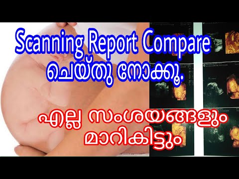 First Trimester Scanning Report || Types Of Scanning During Pregnancy Malayalam Video