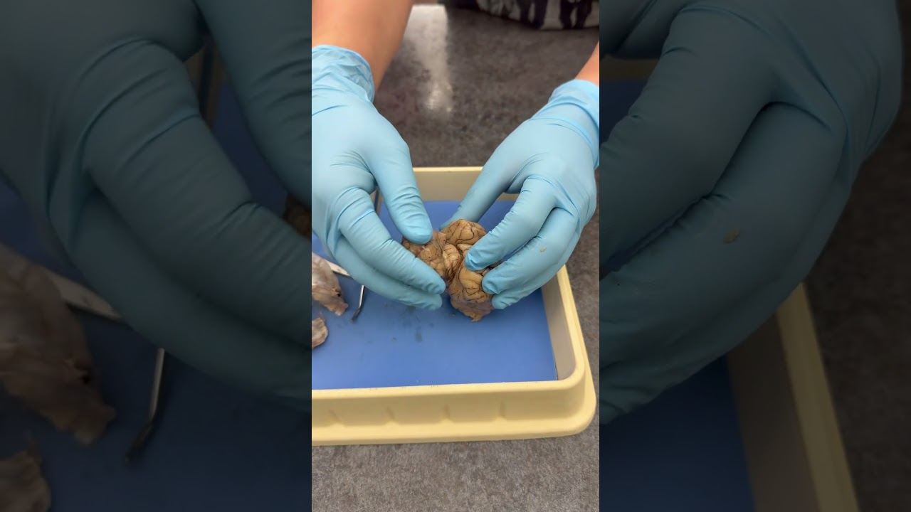 Dissection Day - “The Brain”