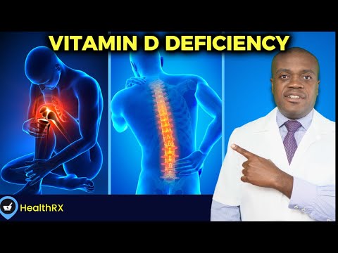 6 Warning Signs Of Low Vitamin D | Signs Of Vitamin D Deficiency