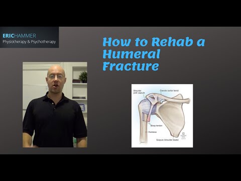 How to Rehab a Humeral Fracture