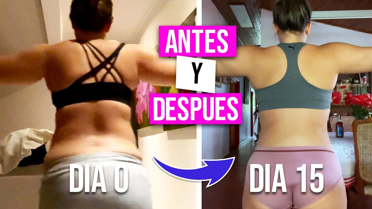 Watch LIPOESCULTURA PARTE 6 | Resultados 15 dias despues de una lipoescultura con fotos del antes Now LIPOESCULTURA PARTE 6 | Resultados 15 dias despues de una lipoescultura con fotos del antes