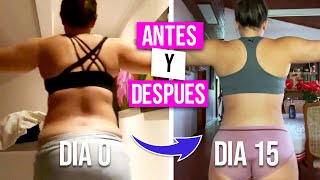 LIPOESCULTURA PARTE 6 | Resultados 15 dias despues de una lipoescultura con fotos del antes