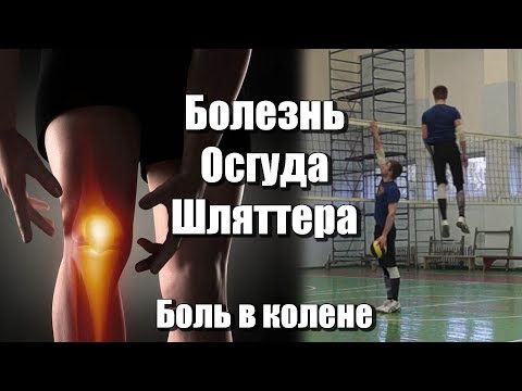 Действие тироксина на суставы Операция на коленном суставе клиника илизарова